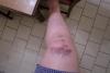 post-418-12638475295949_thumb.jpg