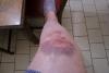 post-418-1264195435,109_thumb.jpg